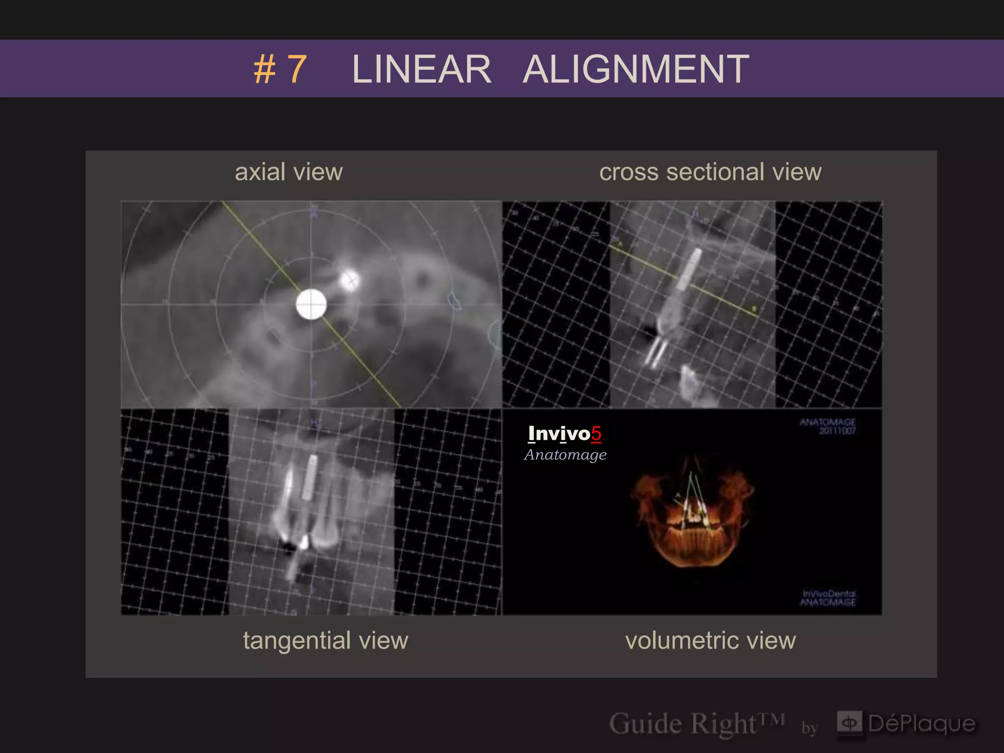 #7          LINEAR ALIGNMENT

axial view                     cross sectional view




                   `



                       Invivo5
                       Anatomage




tangential view                    volumetric view
 