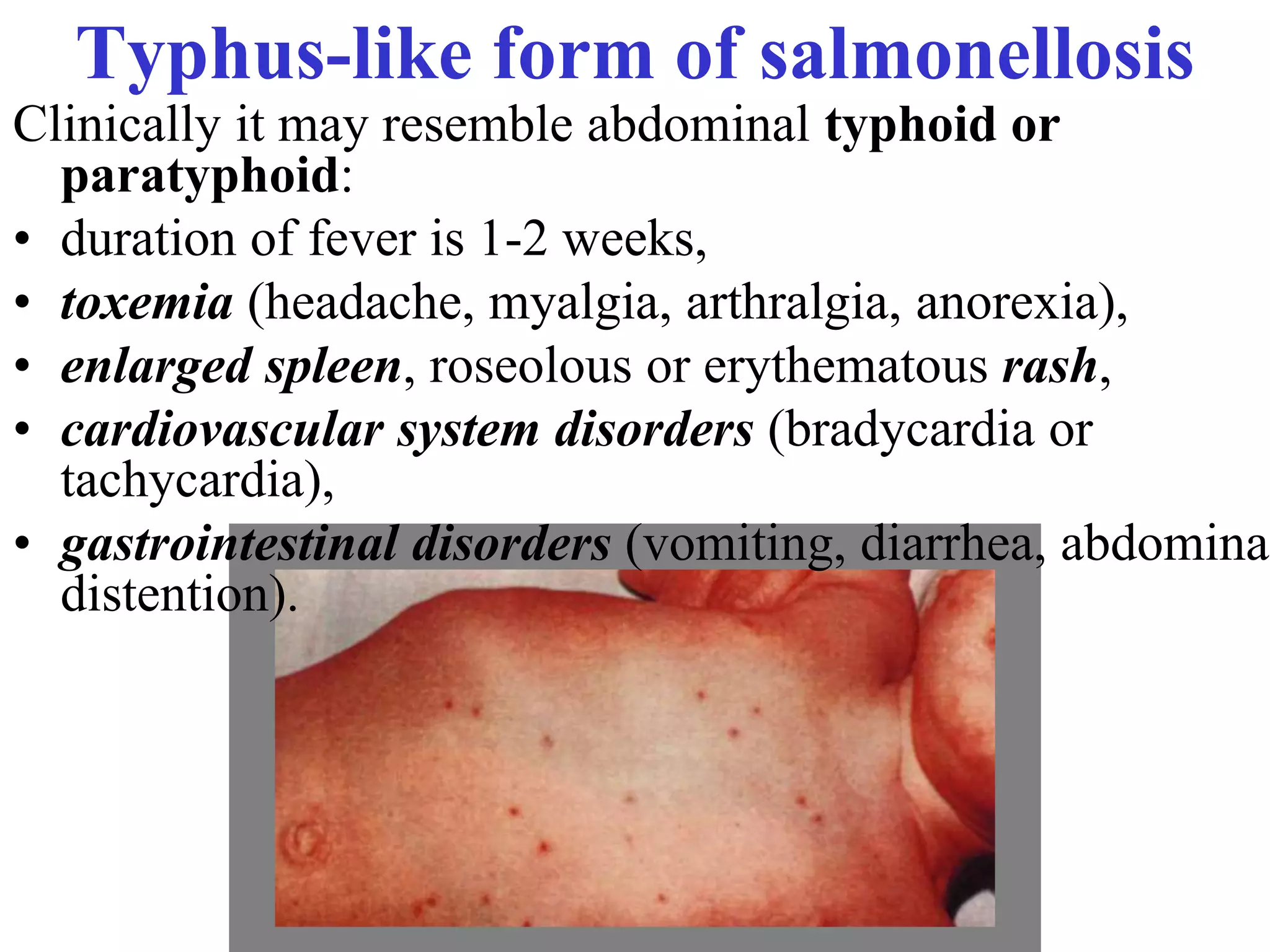 Acute intestinal infections | PPT