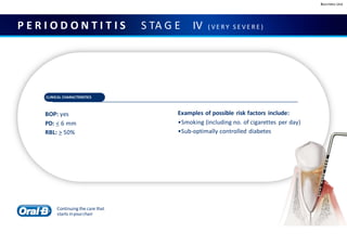 Business Use
P E R I O D O N T I T I S S TA G E IV ( V E R Y S E V E R E )
CLINICAL CHARACTERISTICS
BOP: yes
PD: < 6 mm
RBL: > 50%
Examples of possible risk factors include:
•Smoking (including no. of cigarettes per day)
•Sub-optimally controlled diabetes
Continuing the care that
starts inyourchair
 