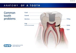 Business Use
A N AT O M Y O F A T O O T H
Common
tooth
problems
Crack
Enamel
Dentine
Pulp
(nerves & bloodvessels)
Filling
Caries
Gum
Continuing the care that
starts inyourchair
 