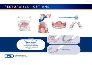 Business Use
R E S T O R AT I V E O P T I O N S
Adhesives
Biggest advantages for
denture wearers:
•Patient Confidence
•Strong long-lasting hold
•Movement reductions
• Food seal
Full Denture
Partial Denture
Continuing the care
that starts in your chair
 