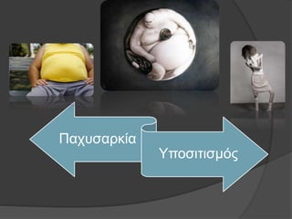 Παχυσαρκία
Υποσιτισμός
 