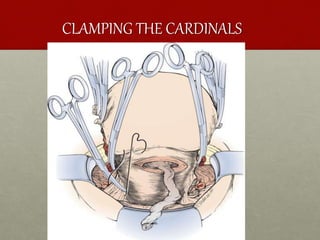 CLAMPING THE CARDINALS
 