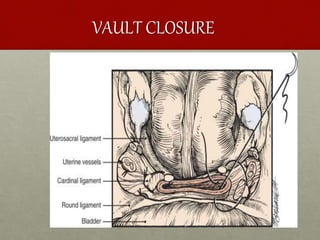 VAULT CLOSURE
 