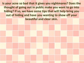 Is your acne so bad that it gives you nightmares? Does the
  thought of going out in public make you want to go into
  hiding? If so, we have some tips that will help bring you
    out of hiding and have you wanting to show off your
                   beautiful and clear skin.
 