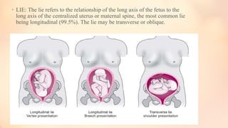 Feto pelvic relationship lie position ppt | PPT