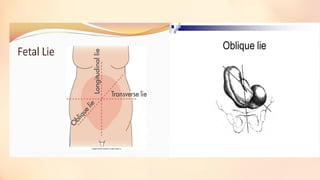 Feto pelvic relationship lie position ppt | PPTX
