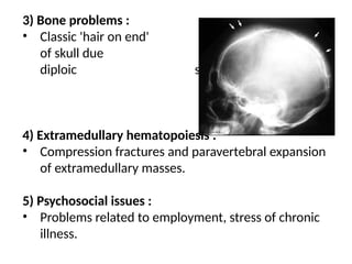 105 Hemolytic anemia-1 thalassemia and sickle cell anemia | PPTX