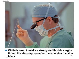 Figure 5.9b
Chitin is used to make a strong and flexible surgical
thread that decomposes after the wound or incision
heals. 33
 