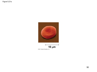 Figure 5.21a
10 m
90
 