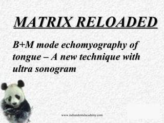 MATRIX RELOADEDMATRIX RELOADED
B+M mode echomyography ofB+M mode echomyography of
tongue – A new technique withtongue – A new technique with
ultra sonogramultra sonogram
www.indiandentalacademy.com
 