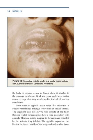 Syphilis Deadly Diseases And Epidemics 2nd Edition Brian Shmaefsky | PDF