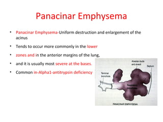 Panacinar Emphysema
• Panacinar Emphysema-Uniform destruction and enlargement of the
acinus
• Tends to occur more commonly in the lower
• zones and in the anterior margins of the lung,
• and it is usually most severe at the bases.
• Common in-Alpha1-antitrypsin deficiency
 
