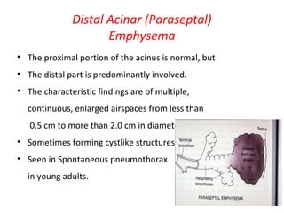 Distal Acinar (Paraseptal)
Emphysema
• The proximal portion of the acinus is normal, but
• The distal part is predominantly involved.
• The characteristic findings are of multiple,
continuous, enlarged airspaces from less than
0.5 cm to more than 2.0 cm in diameter,
• Sometimes forming cystlike structures.
• Seen in Spontaneous pneumothorax
in young adults.
 