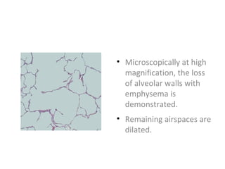 • Microscopically at high
magnification, the loss
of alveolar walls with
emphysema is
demonstrated.
• Remaining airspaces are
dilated.
 