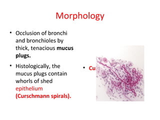 Morphology
• Occlusion of bronchi
and bronchioles by
thick, tenacious mucus
plugs.
• Histologically, the
mucus plugs contain
whorls of shed
epithelium
(Curschmann spirals).
• Curschmann spirals
 