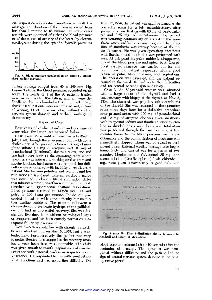 CLOSEDCHEST CARDIAC MASSAGE