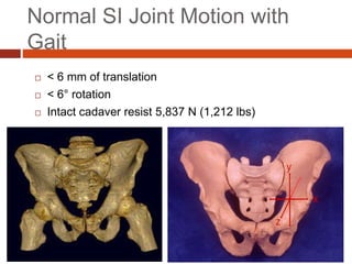 Normal SI Joint Motion with
Gait
 < 6 mm of translation
 < 6° rotation
 Intact cadaver resist 5,837 N (1,212 lbs)
 