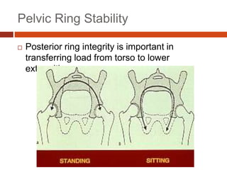 Pelvic Ring Stability
 Posterior ring integrity is important in
transferring load from torso to lower
extremities
 