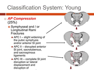 Classification System: Young
 AP Compression
(25%)
 Symphyseal and / or
Longitudinal Rami
Fractures
 APC I – slight widening of
the pubic symphysis
and/or anterior SI joint
 APC II – disrupted anterior
SI joint, sacrotuberous,
and sacrospinous
ligaments
 APC III – complete SI joint
disruption w/ lateral
displacement and
disruption of
 