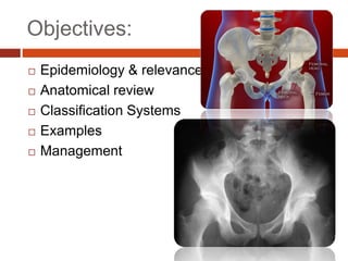 Objectives:
 Epidemiology & relevance
 Anatomical review
 Classification Systems
 Examples
 Management
 