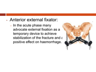 • Anterior external fixator:
– In the acute phase many
advocate external fixation as a
temporary device to achieve
stabilization of the fracture and a
positive effect on haemorrhage.
 