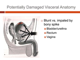 Potentially Damaged Visceral Anatomy
 Blunt vs. impaled by
bony spike
 Bladder/urethra
 Rectum
 Vagina
 