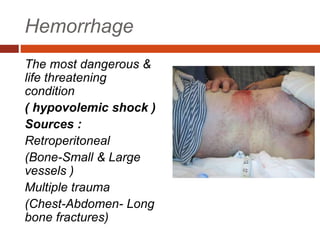 Hemorrhage
The most dangerous &
life threatening
condition
( hypovolemic shock )
Sources :
Retroperitoneal
(Bone-Small & Large
vessels )
Multiple trauma
(Chest-Abdomen- Long
bone fractures)
 