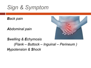 Sign & Symptom
Back pain
Abdominal pain
Swelling & Echymosis
(Flank – Buttock – Inguinal – Perineum )
Hypotension & Shock
 