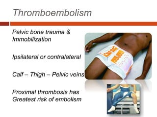 Thromboembolism
Pelvic bone trauma &
Immobilization
Ipsilateral or contralateral
Calf – Thigh – Pelvic veins
Proximal thrombosis has
Greatest risk of embolism
 