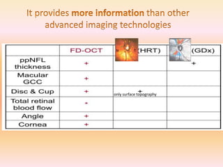 only surface topography
 