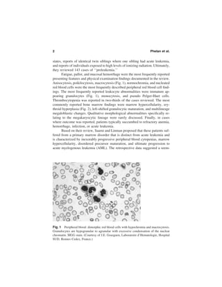 The Myelodysplastic Syndromes Pathobiology And Clinical Management ...