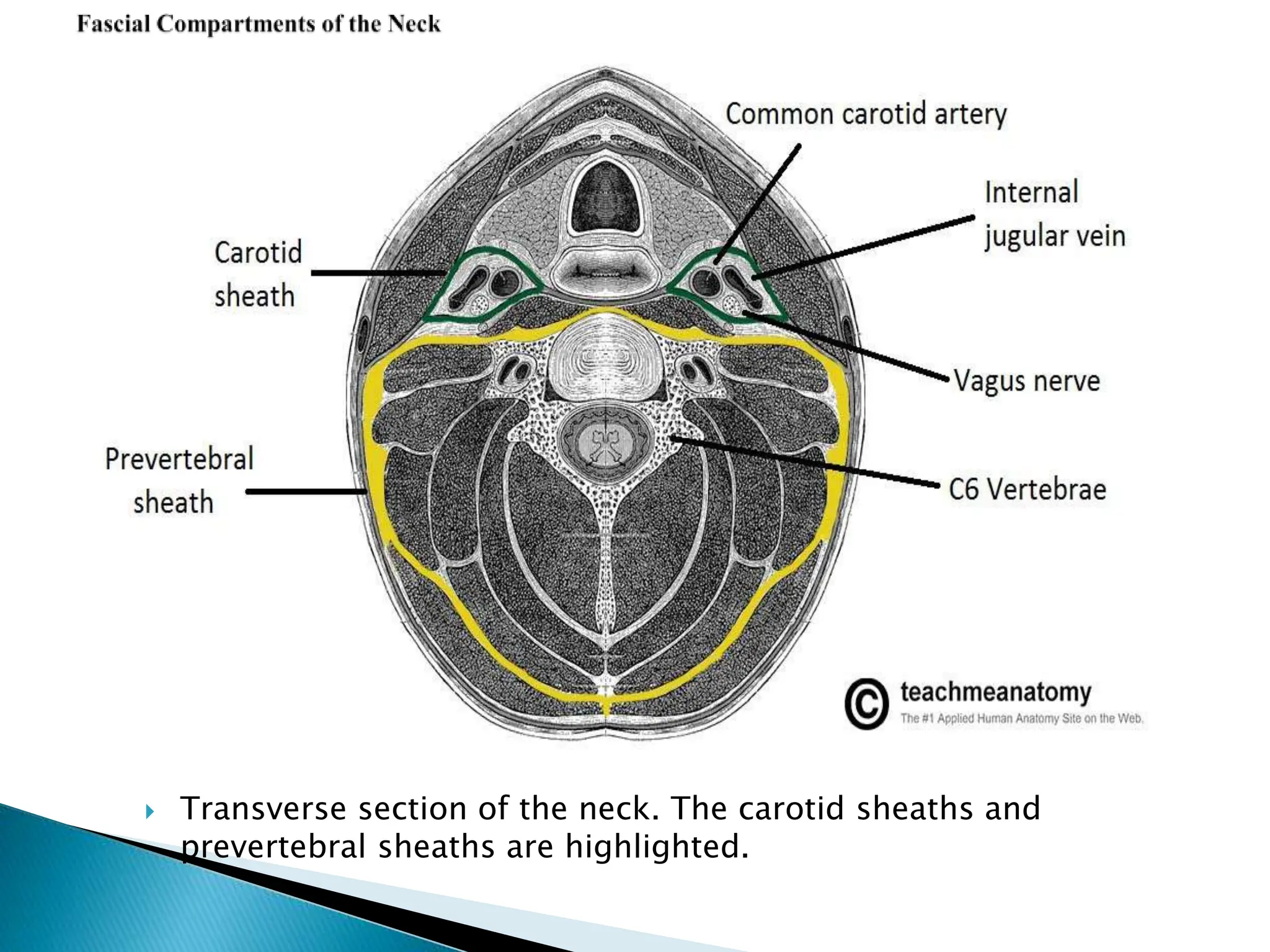  Transverse section of the neck. The carotid sheaths and
prevertebral sheaths are highlighted.
 