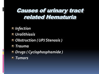 Causes of urinary tract
related Hematuria
Infection
Urolithiasis
Obstruction ( UPJ Stenosis )
Trauma
Drugs ( Cyclophosphamide )
Tumors
 