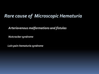 Rare cause of Microscopic Hematuria
Arteriovenous malformations and fistulas
Nutcracker syndrome
Loin pain-hematuria syndrome
 
