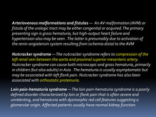 Arteriovenous malformations and fistulas — An AV malformation (AVM) or
fistula of the urologic tract may be either congenital or acquired.The primary
presenting sign is gross hematuria, but high-output heart failure and
hypertension also may be seen .The latter is presumably due to activation of
the renin-angiotensin system resulting from ischemia distal to the AVM
Nutcracker syndrome —The nutcracker syndrome refers to compression of the
left renal vein between the aorta and proximal superior mesenteric artery.
Nutcracker syndrome can cause both microscopic and gross hematuria, primarily
in children (but also adults) in Asia .The hematuria is usually asymptomatic but
may be associated with left flank pain. Nutcracker syndrome has also been
associated with orthostatic proteinuria.
Loin pain-hematuria syndrome —The loin pain-hematuria syndrome is a poorly
defined disorder characterized by loin or flank pain that is often severe and
unrelenting, and hematuria with dysmorphic red cell features suggesting a
glomerular origin. Affected patients usually have normal kidney function.
 