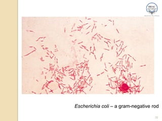 32
Escherichia coli – a gram-negative rod
 