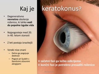 Kaj je keratokonus?
• Degenerativno
nevnetno obolenje
roženice, ki lahko vodi
do popolne izgube vida
• Najpogosteje med 20.
in 40. letom starosti
• Z leti postaja izrazitejši
• Vzroki niso znani
– Delno ga pogojuje
dednost
– Pogost pri ljudeh s
številnimi očesnimi
alergijami
V začetni fazi ga težko odkrijemo
V končni fazi je potrebno presaditi roženico
Morela okulisti
 