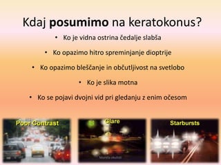 Kdaj posumimo na keratokonus?
• Ko je vidna ostrina čedalje slabša
• Ko opazimo hitro spreminjanje dioptrije
• Ko opazimo bleščanje in občutljivost na svetlobo
• Ko je slika motna
• Ko se pojavi dvojni vid pri gledanju z enim očesom
Morela okulisti
 