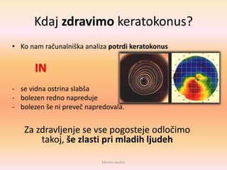 Kdaj zdravimo keratokonus?
• Ko nam računalniška analiza potrdi keratokonus
IN
- se vidna ostrina slabša
- bolezen redno napreduje
- bolezen še ni preveč napredovala.
Za zdravljenje se vse pogosteje odločimo
takoj, še zlasti pri mladih ljudeh
Morela okulisti
 