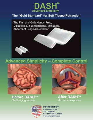 The “Gold Standard” for Soft Tissue Retraction
The First and Only Hands-Free,
Disposable, 3-Dimensional, Malleable,
Absorbent Surgical Retractor
Advanced Simplicity
Advanced Simplicity – Complete Control
Challenging access
Before DASH™ After DASH™
Maximum exposure
DISTRIBUTED BY:
US Surgitech, Inc
327 Village Dr
Carol Stream, IL 60188
www.ussurgitech.com
 