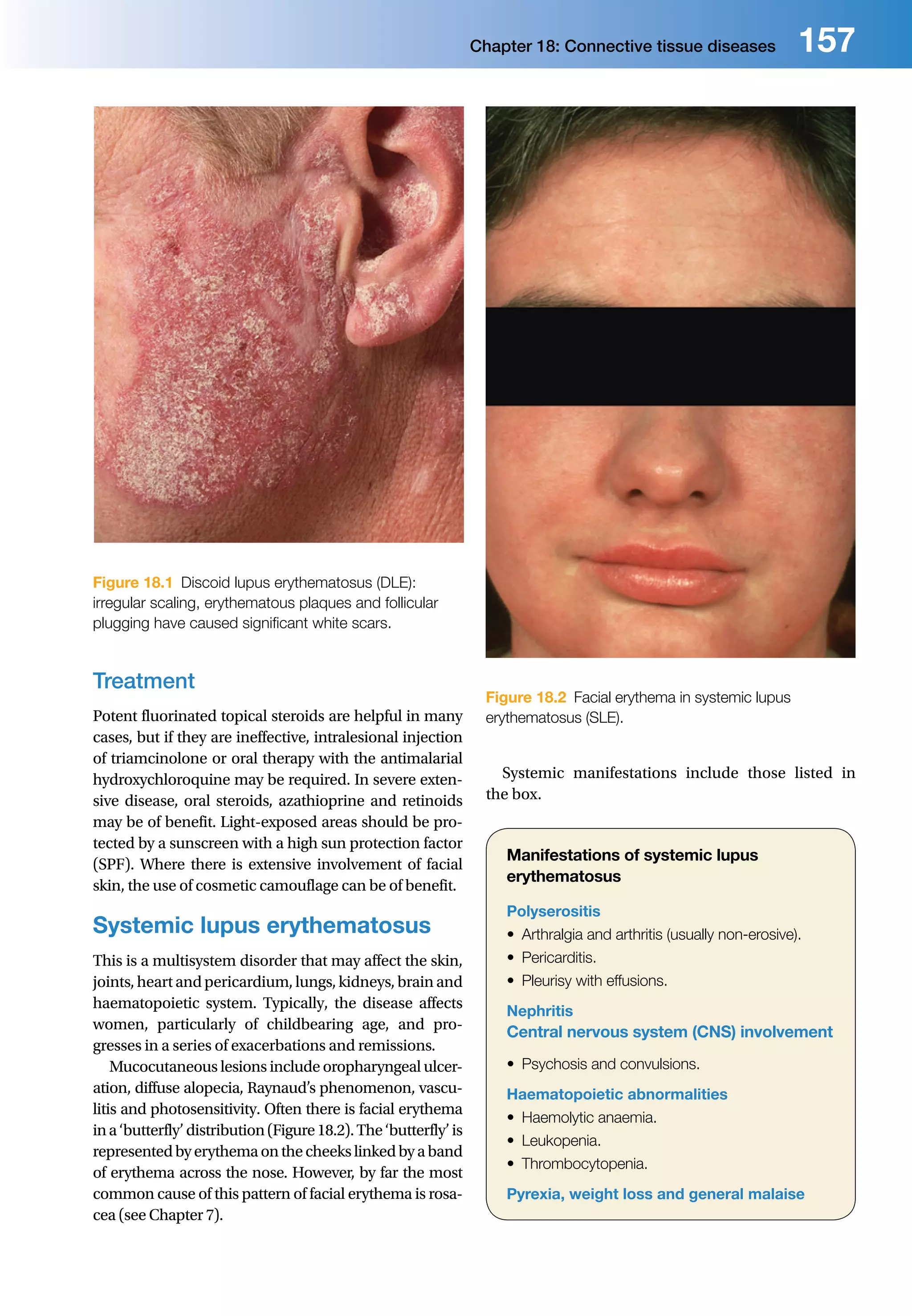 11th autoimmune diseases | PDF | Skin and Dermatology | Diseases and ...