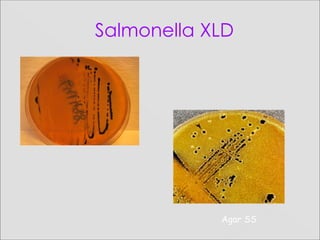 Salmonella XLD
Agar SS
 