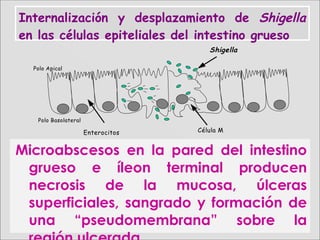 Shigella
Célula MEnterocitos
Polo Apical
Polo Basolateral
Internalización y desplazamiento de Shigella
en las células epiteliales del intestino grueso
Microabscesos en la pared del intestino
grueso e íleon terminal producen
necrosis de la mucosa, úlceras
superficiales, sangrado y formación de
una “pseudomembrana” sobre la
 