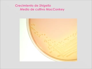 Crecimiento de Shigella
Medio de cultivo MacConkey
 