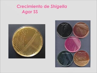 Crecimiento de Shigella
Agar SS
 