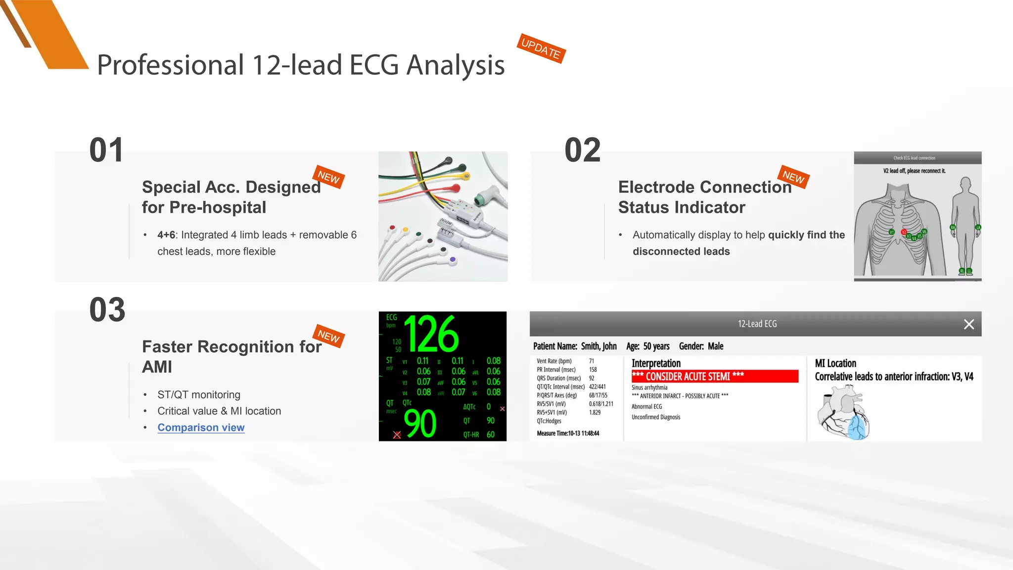 院前12导附
件图
01
• 4+6: Integrated 4 limb leads + removable 6
chest leads, more flexible
Special Acc. Designed
for Pre-hospital
ST/QT界面
图
03
• ST/QT monitoring
• Critical value & MI location
• Comparison view
Faster Recognition for
AMI
12导导联脱
落界面图
02
• Automatically display to help quickly find the
disconnected leads
Electrode Connection
Status Indicator
 