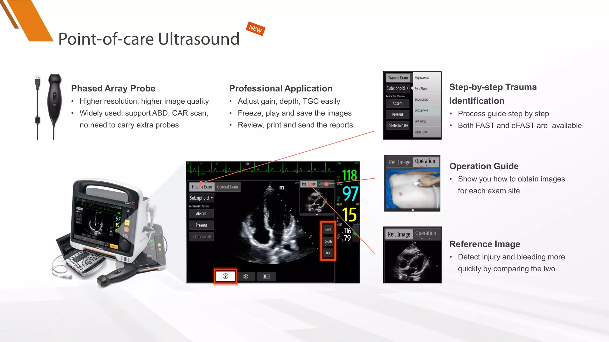 PEA
Phased Array Probe
• Higher resolution, higher image quality
• Widely used: support ABD, CAR scan,
no need to carry extra probes
Professional Application
• Adjust gain, depth, TGC easily
• Freeze, play and save the images
• Review, print and send the reports
Step-by-step Trauma
Identification
• Process guide step by step
• Both FAST and eFAST are available
Reference Image
• Detect injury and bleeding more
quickly by comparing the two
Operation Guide
• Show you how to obtain images
for each exam site
 