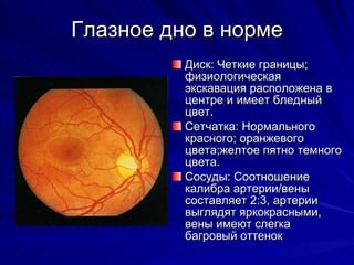 Глазное дно в норме Диск: Четкие границы; физиологическая экскавация расположена в центре и имеет бледный цвет. Сетчатка: Нормального красного; оранжевого цвета;желтое пятно темного цвета.   Сосуды: Соотношение калибра артерии/вены составляет 2:3, артерии выглядят яркокрасными, вены имеют слегка багровый оттенок 