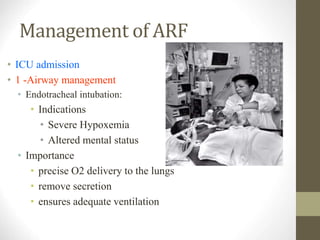 Management of ARF
• ICU admission
• 1 -Airway management
• Endotracheal intubation:
• Indications
• Severe Hypoxemia
• Altered mental status
• Importance
• precise O2 delivery to the lungs
• remove secretion
• ensures adequate ventilation
 